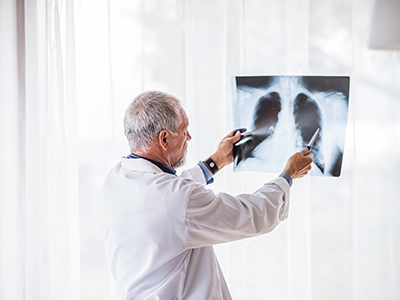 Que especialista se encarga de los pulmones en CDMX