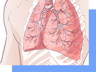 Especialista en enfermedades pulmonares en CDMX