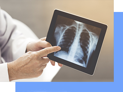 Médico especialista en bronquitis en CDMX