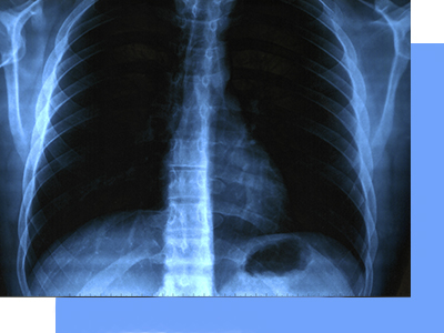 Médico especialista de pulmones en CDMX